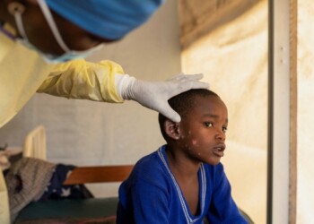 OMS declara, nuevamente, al mpox como emergencia sanitaria mundial